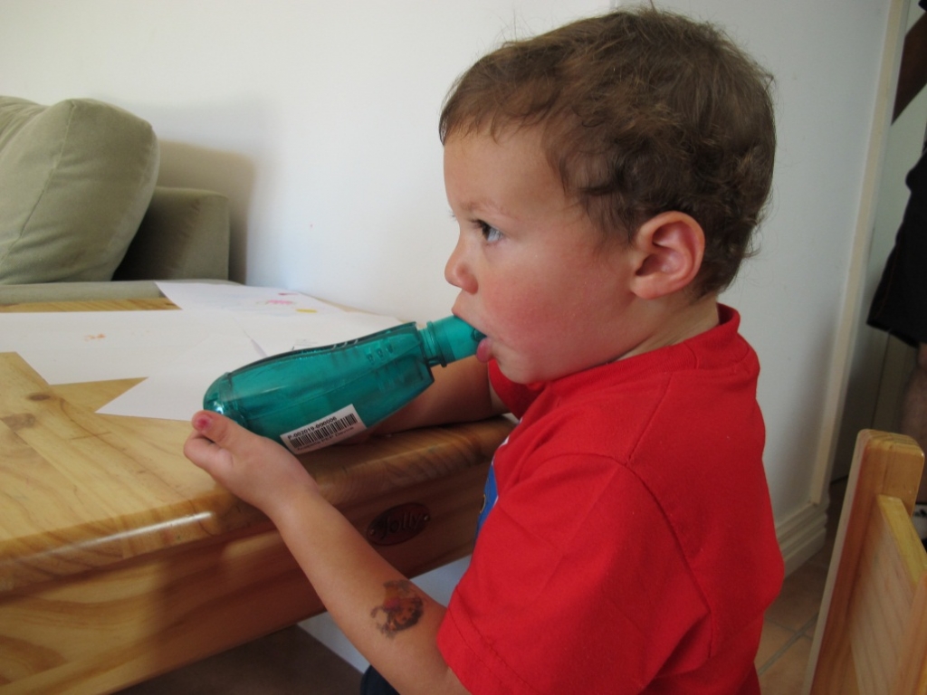 Acapella Bronchiectasis