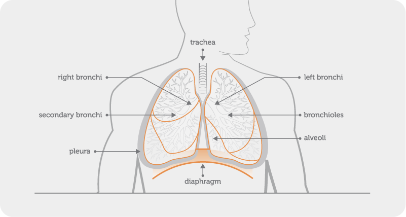BW - the lungs - Bronchiectasis